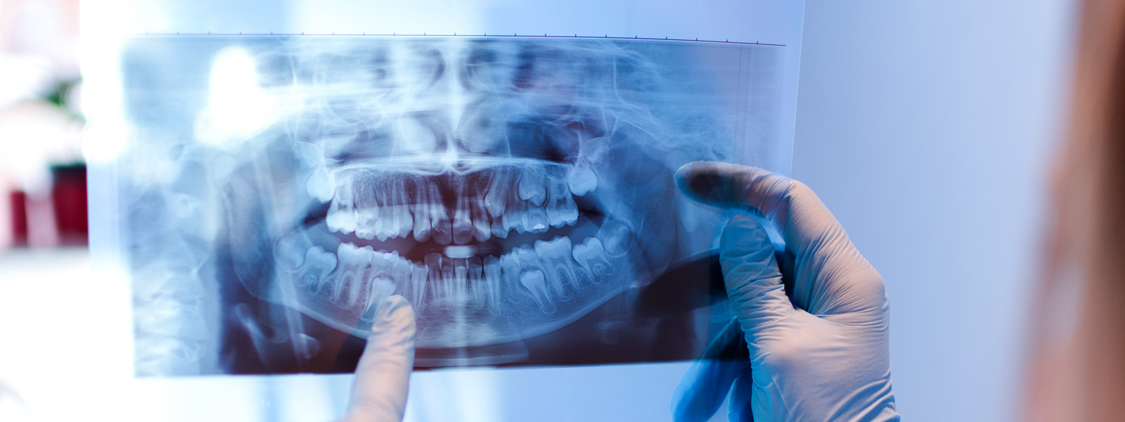 Dental