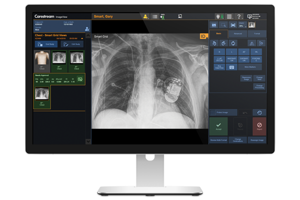 Logiciel ImageView